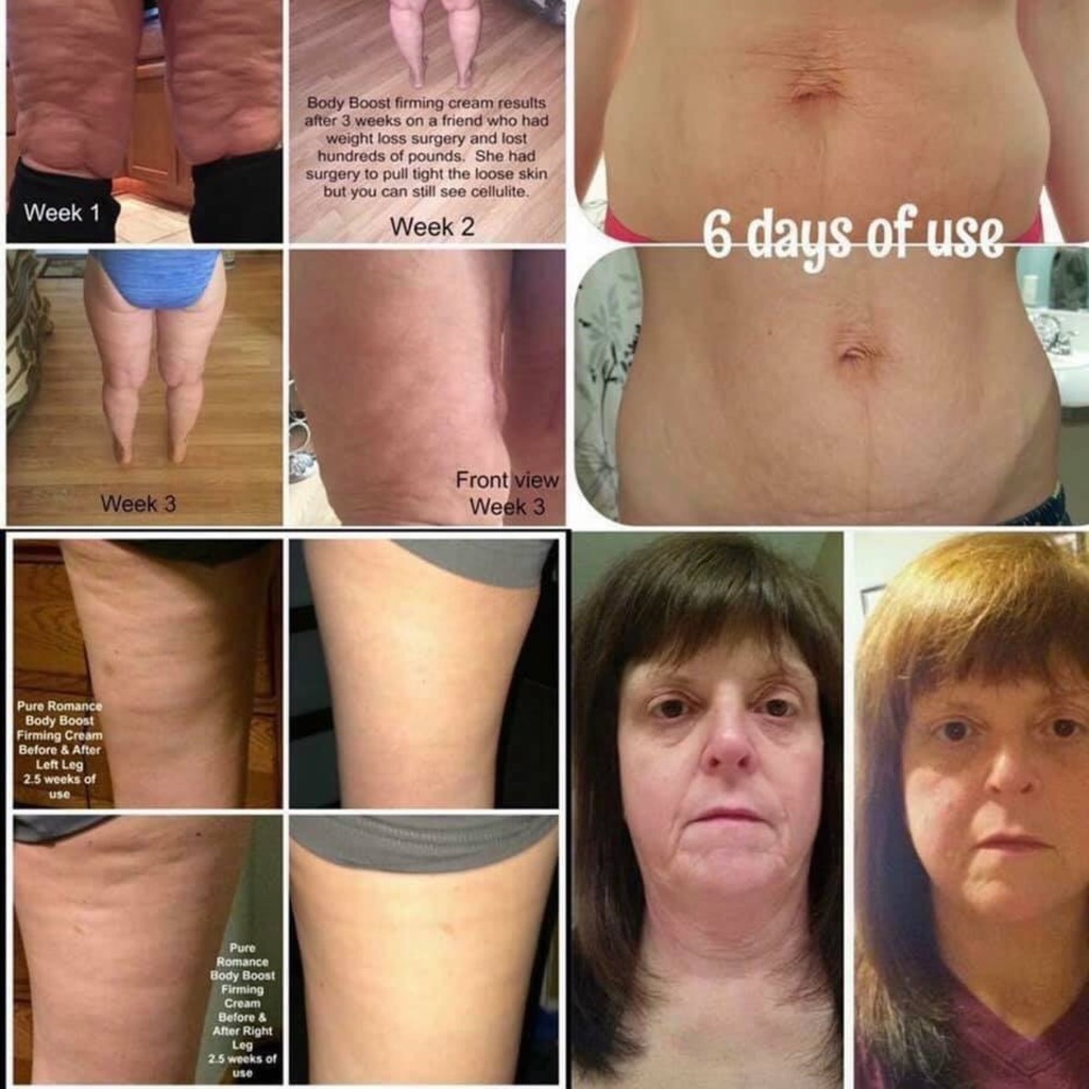 Anti-cellulite Firming Cream Body Boost - Picture 3 of 7
